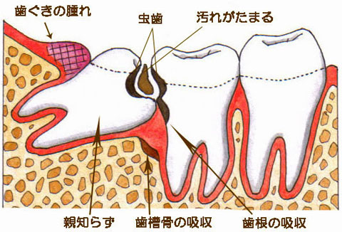 画像3